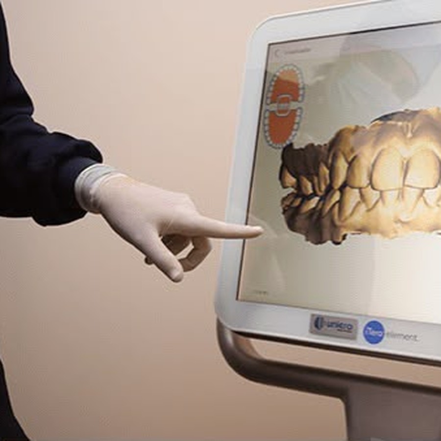 Scanner 3D